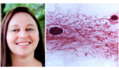 Dr. Dana Brantley-Sieders (left) and a mammary gland whole mount (right). Photos provided by Dr. Brantley-Sieders