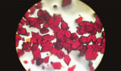 Rachael Pickens' photo of Ruthenium rubies